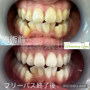 【1回来店でおわるコース♡】