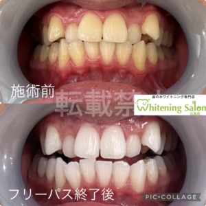 【甘い物好きの方は注意⚠️】