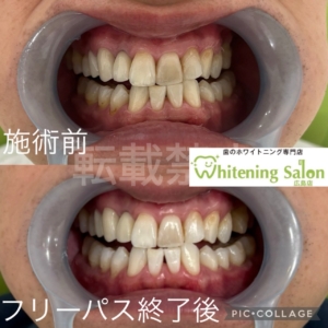 【食後の歯磨き🪥🌙】