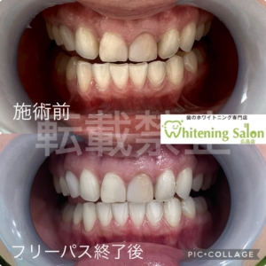 【歯が痛むときにすること、してはいけないこと】