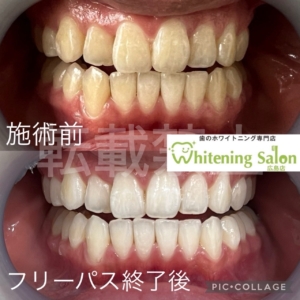 【ステインについて】