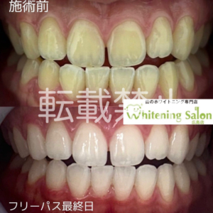 【歯医者の大切さ】