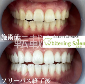 【夏バテと歯】