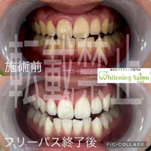 【7月のご予約お早めに🎀】