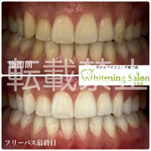 【果物と歯】