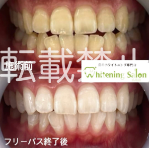 【カウンセリング予約🎶】
