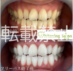 【遺伝✨】