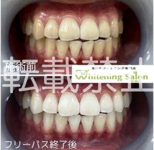 【熱中症😫】