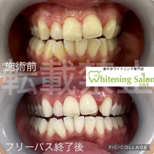 【お肉と歯の関係✓】
