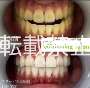【アレルギーについて】
