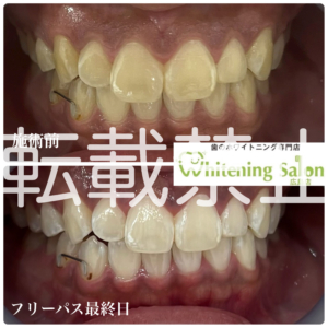 【歯磨き粉🪥】