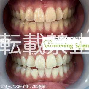 【集中コース💗】