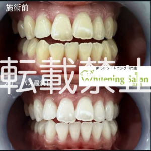 【集中コース🌙】