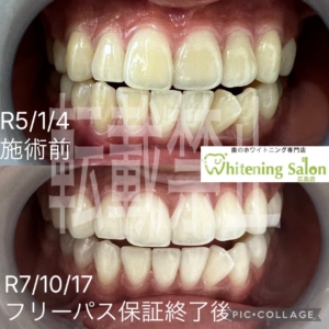 【秋の体調不良、歯も不調🍂】