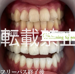 【エナジードリンクについて😖】広島/ホワイトニング