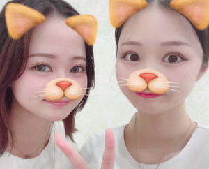 【歯の黄ばみとチョコケーキ】広島/ホワイトニング