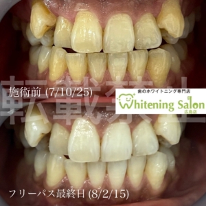 【辛さと味蕾🌶】広島/ホワイトニング